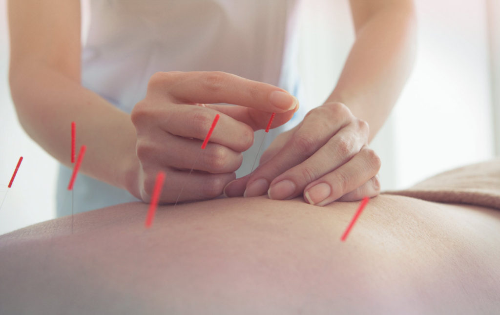 Medicina tradicional China y Acupuntura en centro ISMET