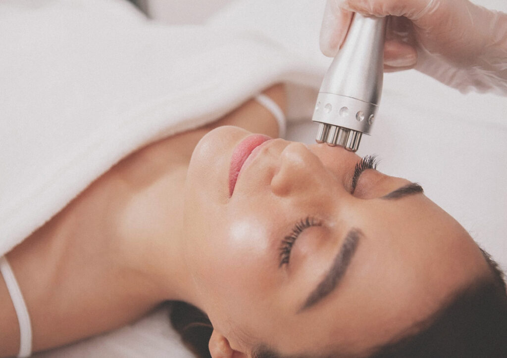 Radiofrecuencia facial